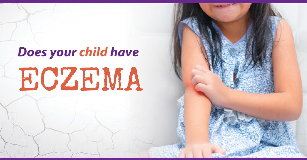 Does Your Child Have Eczema?